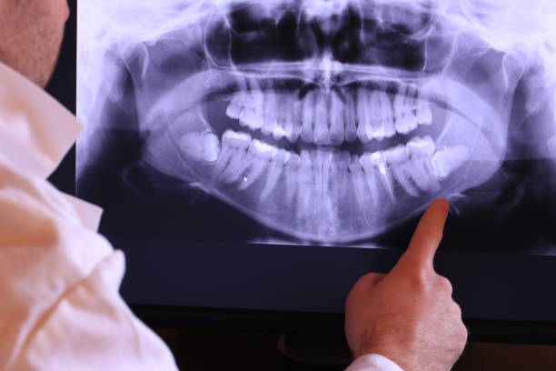 Best Urgent Care for Lost Fillings or Crowns in Svis, IL