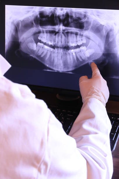 Best Emergency Treatment for Dental Infections or Abscesses in Svis, IL